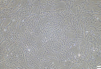 Adipose tissue-derived mesenchymal stem cells (ADMSC)
