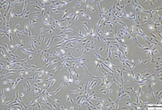Bone marrow-derived mesenchymal stem cells