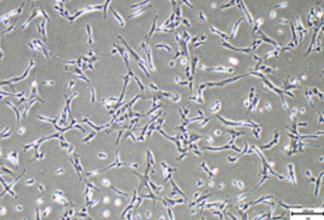 Umbilical cord-derived mesenchymal stem cells
