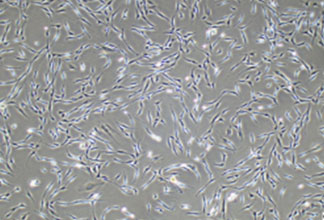 Hair follicle dermal papilla cells