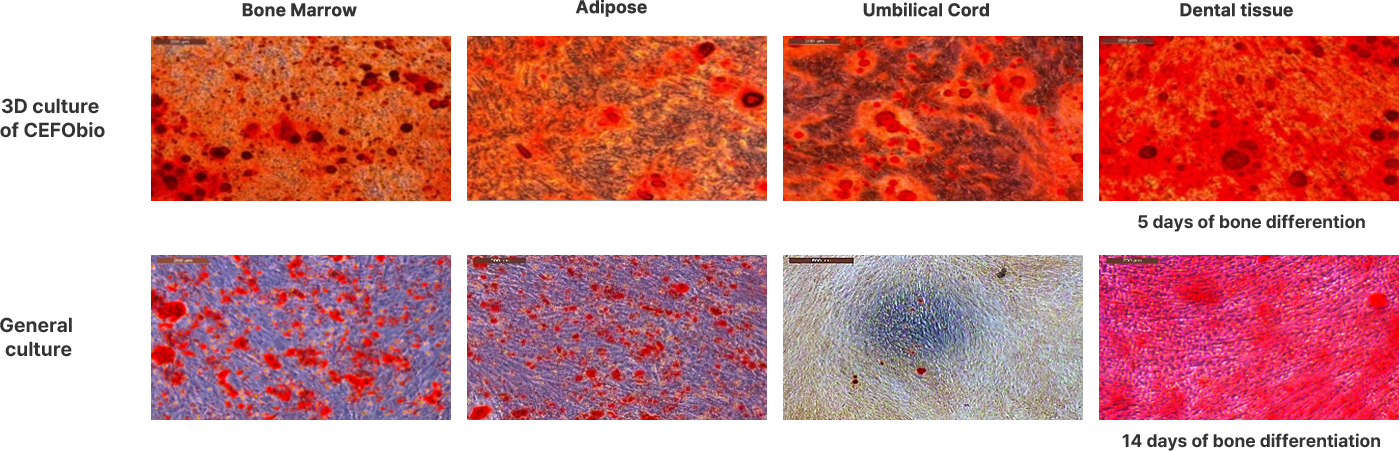 *Alizarin Red staining: Red color indicates calcium deposition and osteocyte differentiation