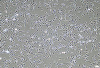 인간 섬유아 세포
