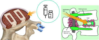 CF-M801 procedure method