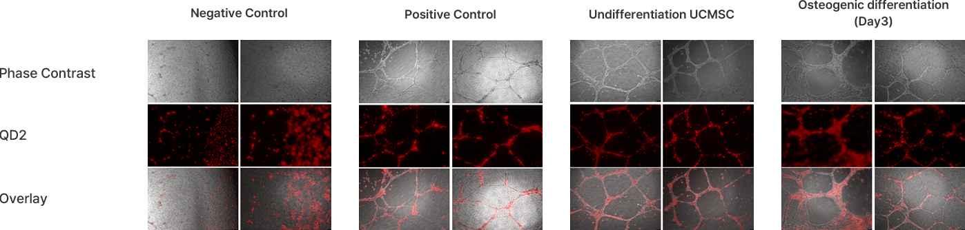 Effect of inducing angiogenesis by cell therapy agent